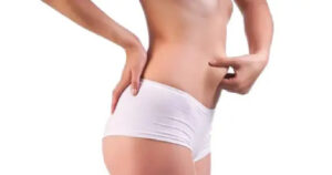 BodyTite Liposuction: A Comprehensive Guide